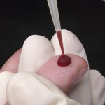 Blood test for enterobiasis