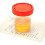 Urine tests. Urine indicators. 