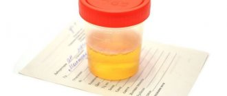 Urine tests. Urine indicators. 