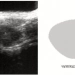 abdominal pain right side