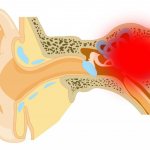 Meniere&#39;s disease: symptoms and treatment