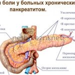 Pain with pancreatitis