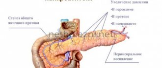 Pain with pancreatitis