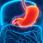 What is superficial gastric bulbitis?