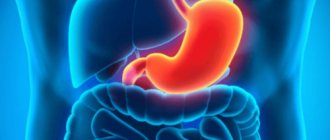 What is superficial gastric bulbitis?