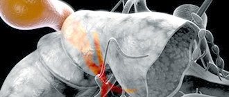 Gallbladder deformity