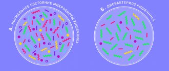 Intestinal dysbiosis: symptoms, causes, state of microbiota