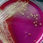 Enterobacteriaceae: what is it?