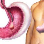 FGDS of the stomach