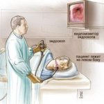 Gastroscopy