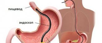 Gastroscopy