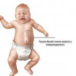 Hernia of the white line of the abdomen in a child