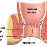 Ка выглядит патология