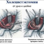 Как происходит удаление