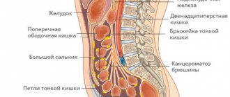 peritoneal carcinomatosis