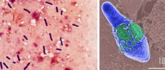 Clostridia mod microscorom have a characteristic appearance