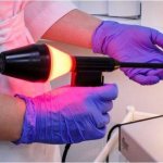 Laser treatment