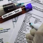 What does the bilirubin level indicate?