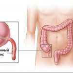 Danger of inflammation of appendicitis