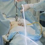 gallbladder removal surgery