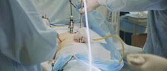 gallbladder removal surgery