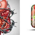 Gastrointestinal tract organs-in-barbed-wire-and-pill-with-healthy-foods-rehabilitation-tips-from-dietetics-school