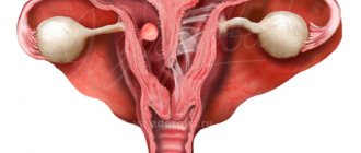 Main types of pathology of the uterine cavity