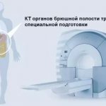 Preparing for an abdominal CT scan