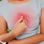 Psychosomatics of heartburn and reflux in women