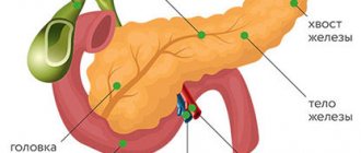 Pancreas cancer