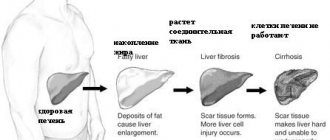 Development of cirrhosis