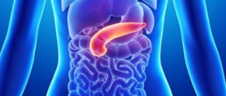 Reactive pancreatitis: causes, symptoms, diagnosis and treatment in adults