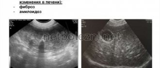 Serious pathologies with diffuse changes