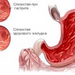 Stomach mucosa