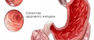 Stomach mucosa