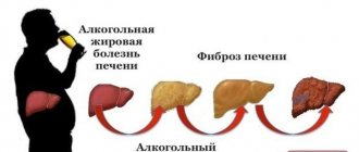 Stages of alcohol disease