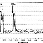 Daily graph of gastric acidity in healthy people and patients with duodenal ulcers