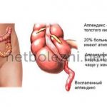 Course of the disease