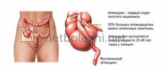 Course of the disease