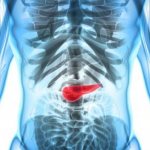 Enlarged pancreas: causes and treatment, diet