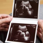 Ultrasound and fetal pathologies