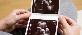 Ultrasound and fetal pathologies