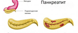 варенье при панкреатите