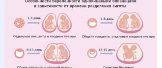 Options for the development of monozygotic twins