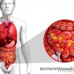 Воспаление при патологии