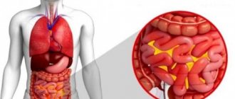 Inflammation in pathology