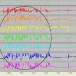 Swallowing large amounts of air while eating (Bordin D.S. et al.))