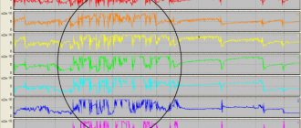 Swallowing large amounts of air while eating (Bordin D.S. et al.))