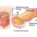 It is forbidden to eat any food that increases the production of enzymes designed to break down food.