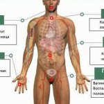 Areas prone to candidiasis infection